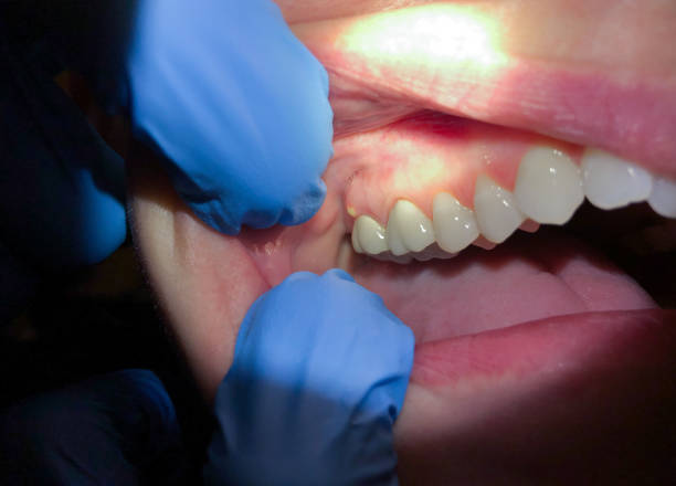 Best Dentist Open Late Near Me  in Richnd, MO
